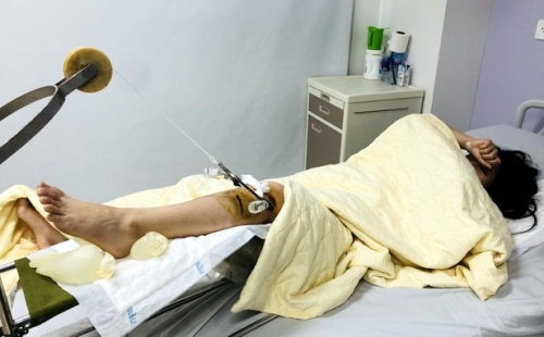Nữ sinh viên tên T. đang được điều trị tại Bệnh viện Trung ương Quân đội 108. (Ảnh: CTV)