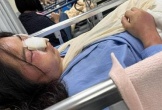 Phẫn nộ chuyện cô gái quê Nghệ An bị bạn trai đánh nhập viện, khâu 14 mũi chỉ vì... tô son