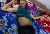 Khốn khó vì mắc bệnh ung thư gan di căn xương